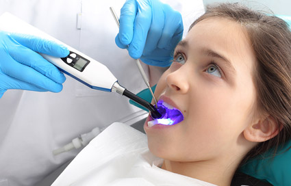 Preventive dentistry sealants