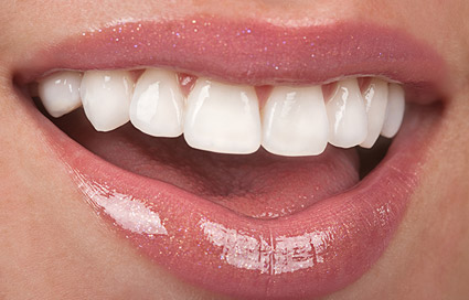 Cosmetic dentistry teeth reshaping